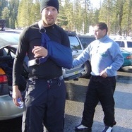 Broke my shouilder snowboarding at Mammoth